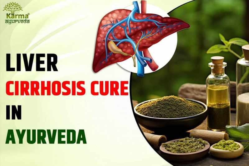 Liver Cirrhosis Cure in Ayurveda - Karma Ayurveda