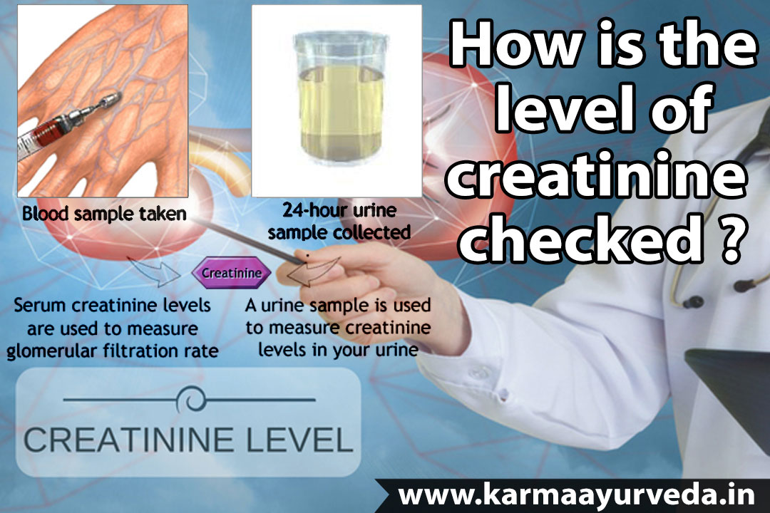 What Level Of Creatinine Indicates Kidney Failure